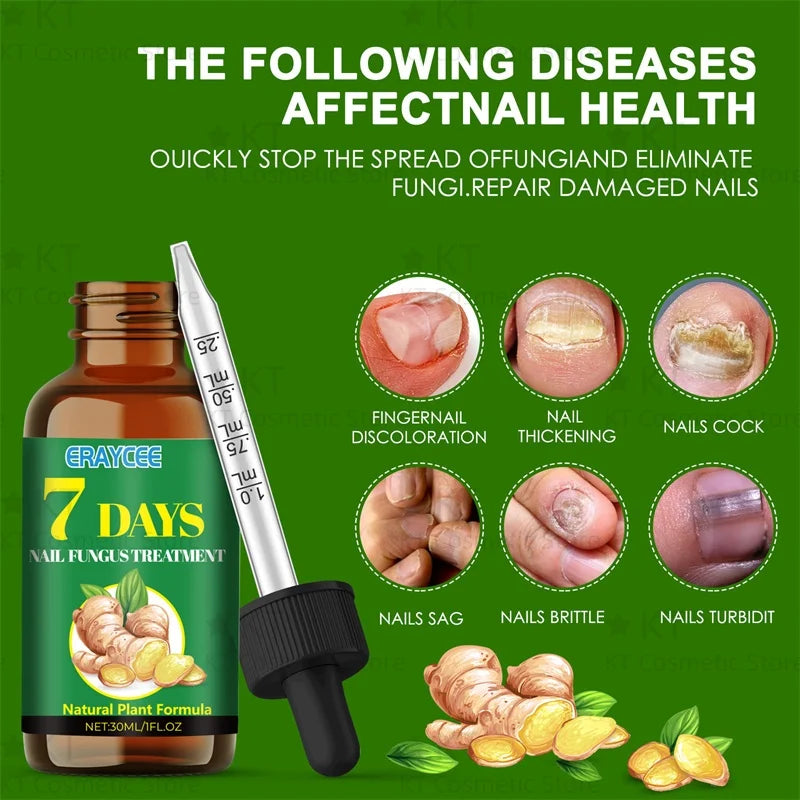Serum Antihongos para Uñas
