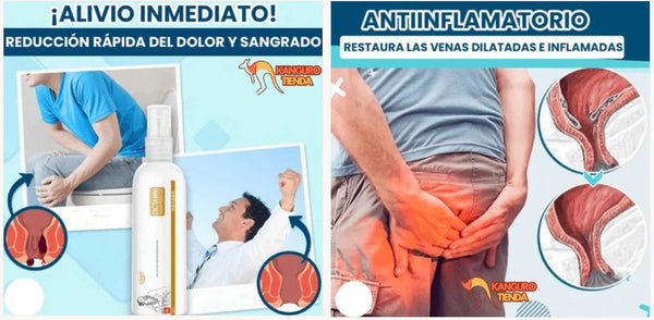 Gel Calmante de Hemorroides