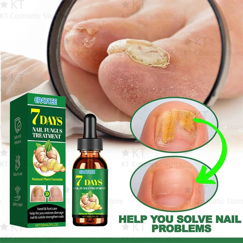 Serum Antihongos para Uñas